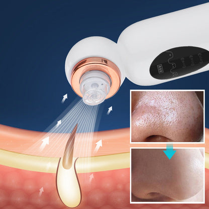 Hydrodermabrasion Gerät Mitesserentferner