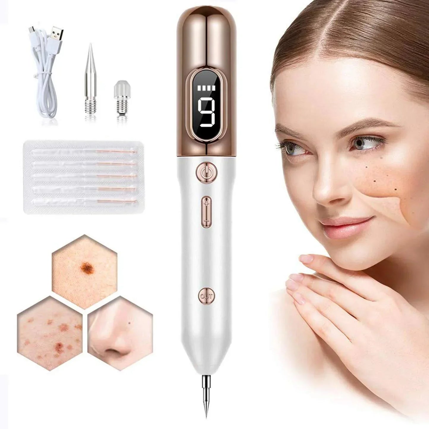 Plasma-Stift zur Entfernung von Hautmakeln
