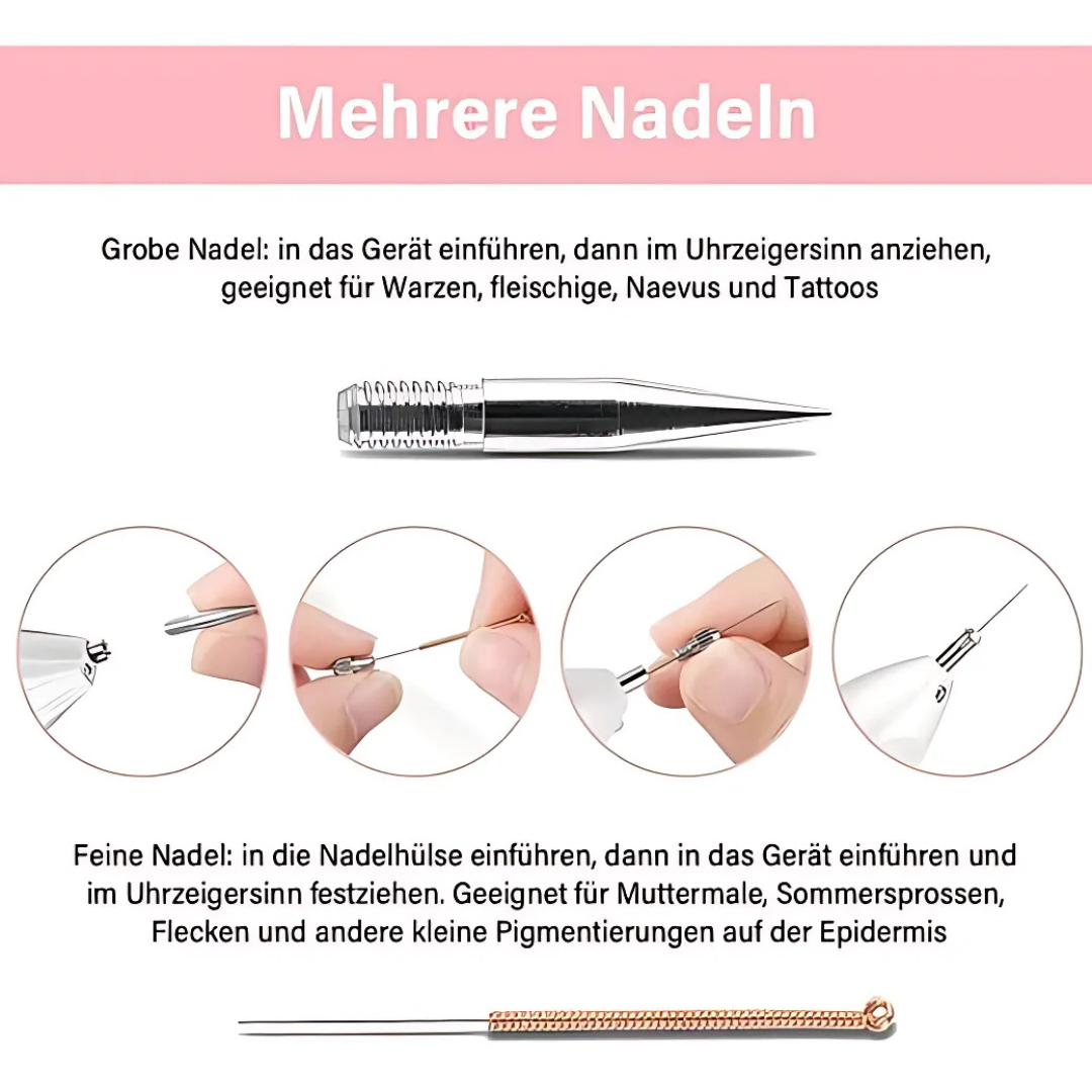 Plasma-Stift zur Entfernung von Hautmakeln