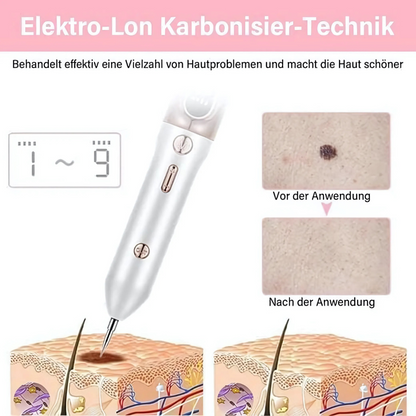 Plasma-Stift zur Entfernung von Hautmakeln