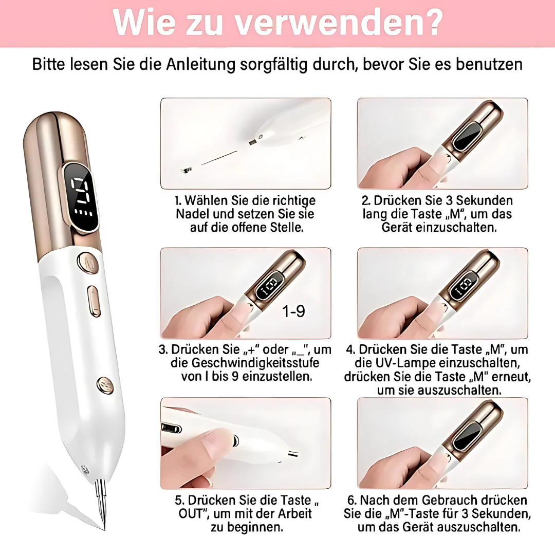 Plasma-Stift zur Entfernung von Hautmakeln