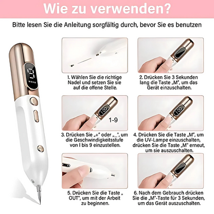Plasma-Stift zur Entfernung von Hautmakeln