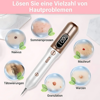 Plasma-Stift zur Entfernung von Hautmakeln