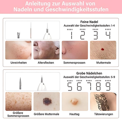Plasma-Stift zur Entfernung von Hautmakeln